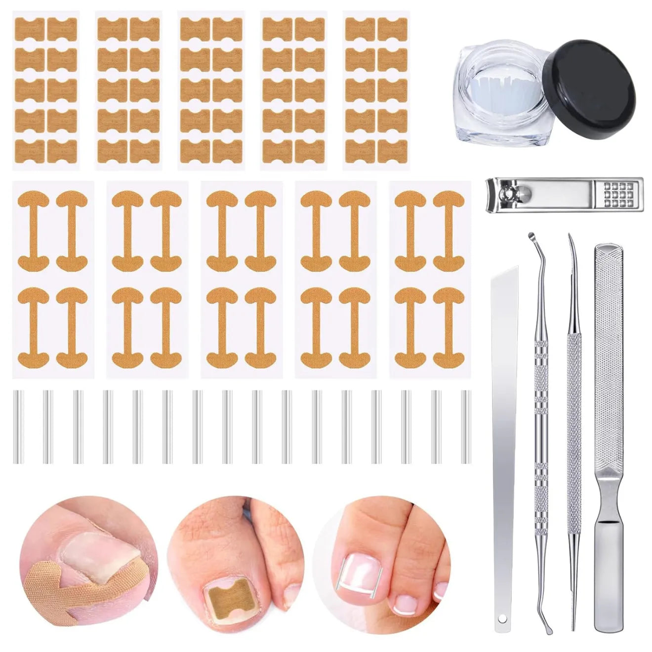 Kit Anti-Ongle Incarné – Soulagement Sans Douleur