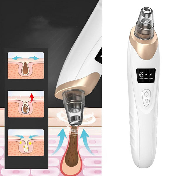 Pro Blackhead Vacuum Cleaner™ – Instant Results