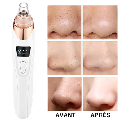 Pro Blackhead Vacuum Cleaner™ – Instant Results