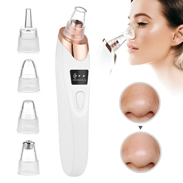 Pro Blackhead Vacuum Cleaner™ – Instant Results