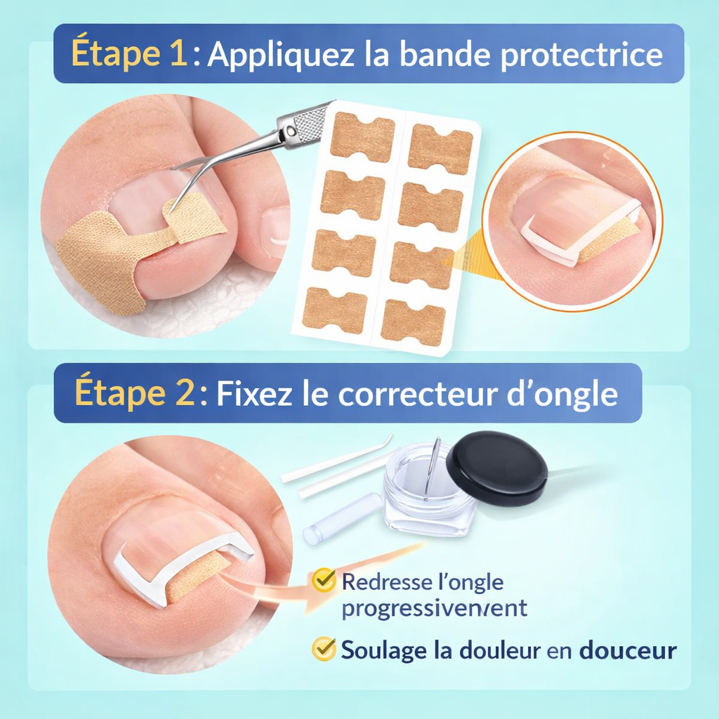 Kit Anti-Ongle Incarné – Soulagement Sans Douleur