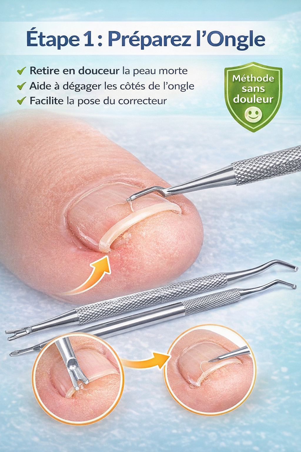 Kit Anti-Ongle Incarné – Soulagement Sans Douleur