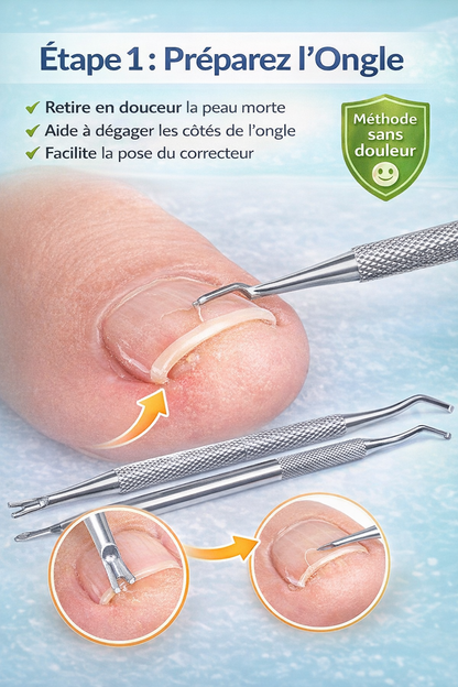 Kit Anti-Ongle Incarné – Soulagement Sans Douleur