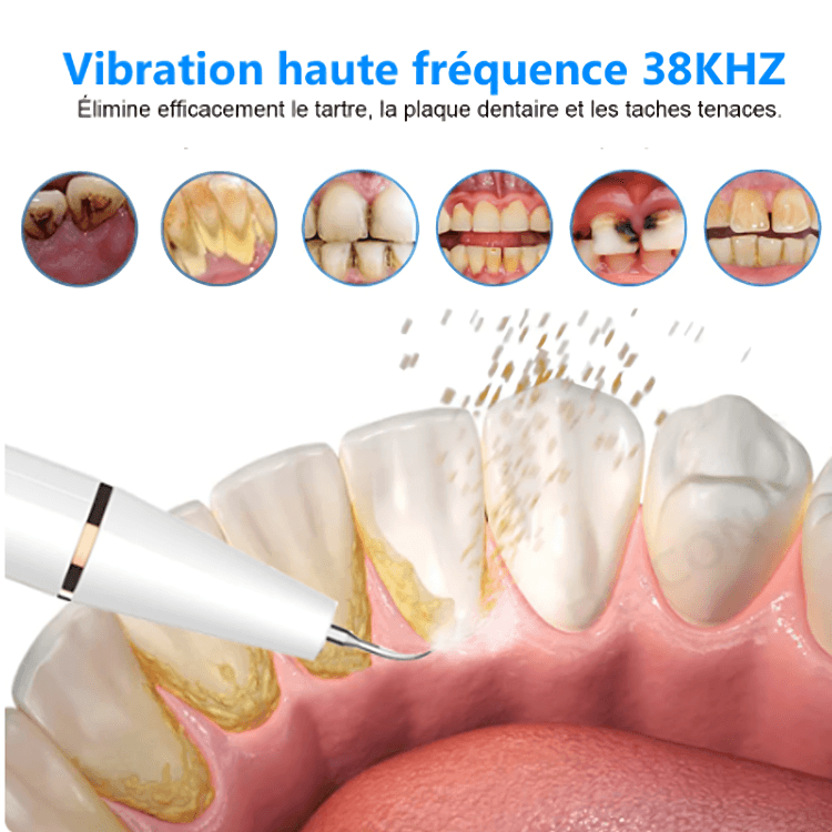Détartrage Maison Pro™ – Le Kit Complet Pour Un Sourire Parfait