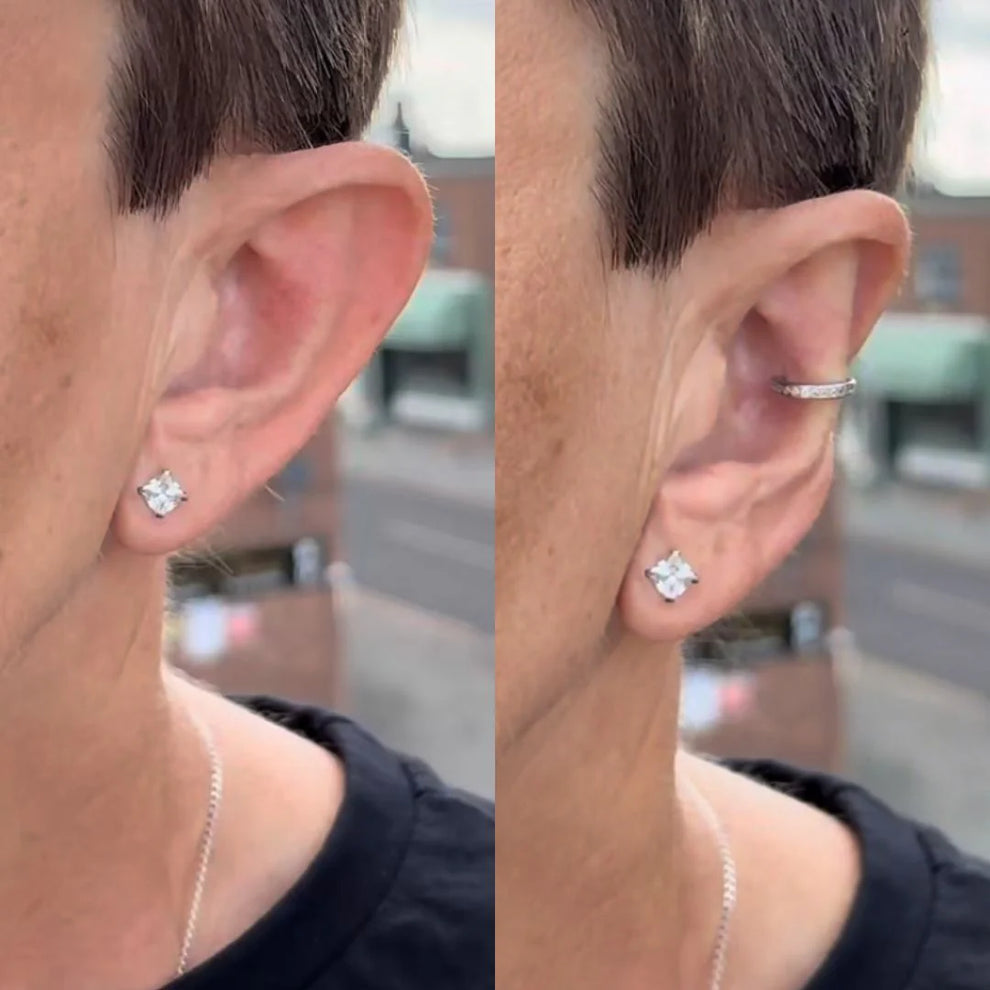 EarFix™ – Oreilles Collées Instantanément