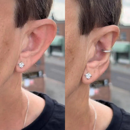 EarFix™ – Oreilles Collées Instantanément