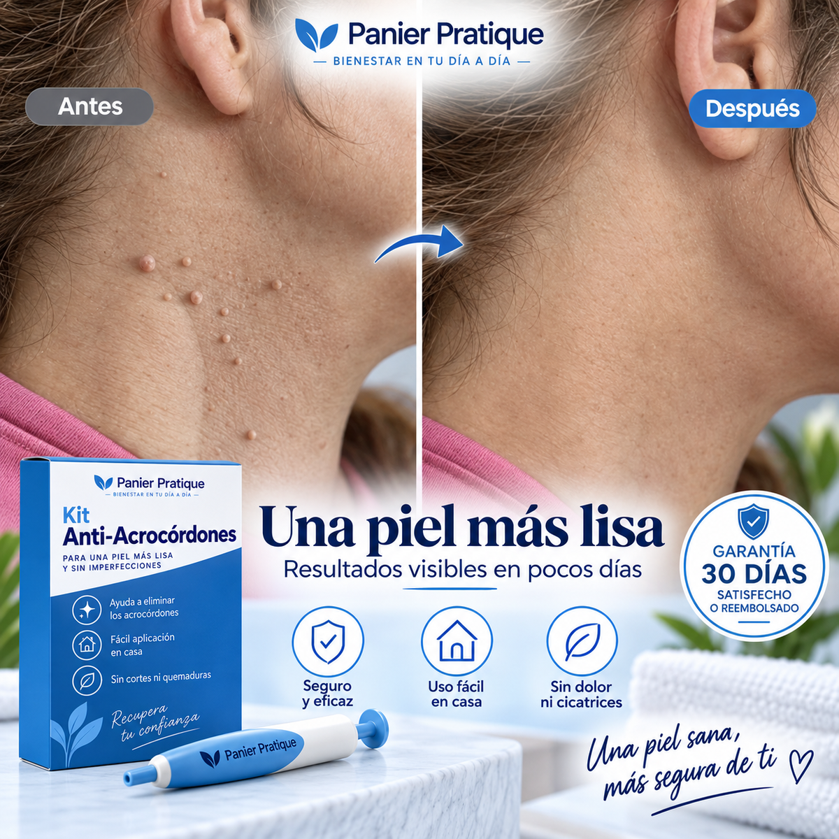 AcroPrécis — Aplicador de bandas para acrocordones